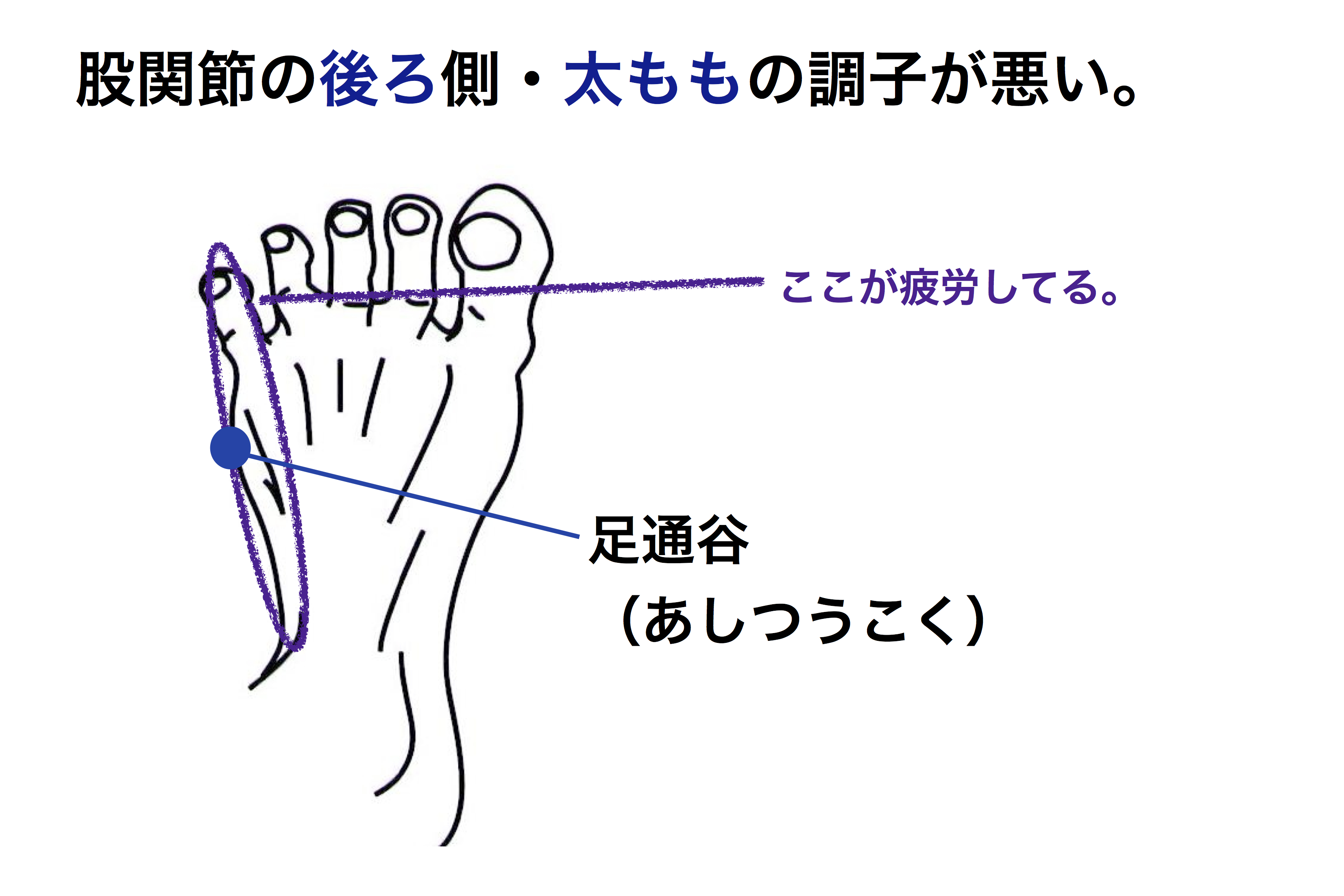 バレエで股関節の動きが悪い 痛いときのアプローチ ４ バレエダンサーさんの治療院