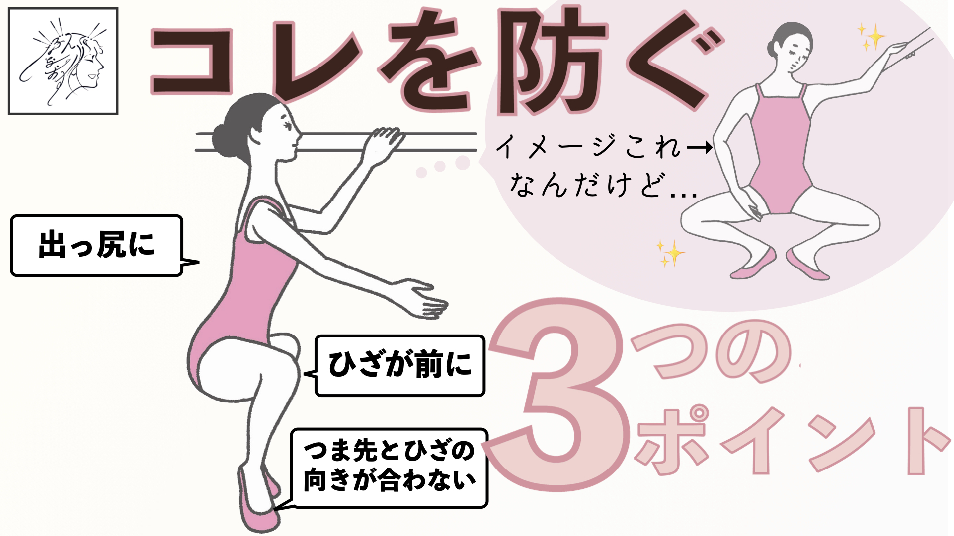 プリエでお尻が出たり 膝が外に開かない 股関節開かない 原因と意識したい３つのポイント バレエダンサーさんの治療院