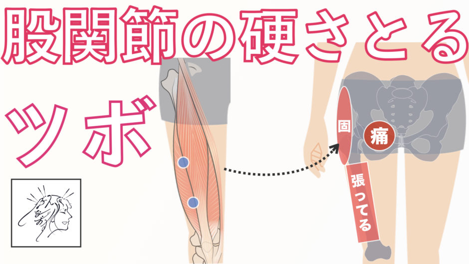 股関節 ソ径部 が痛い 硬いときにほぐしたいツボ バレエダンサーさんの治療院