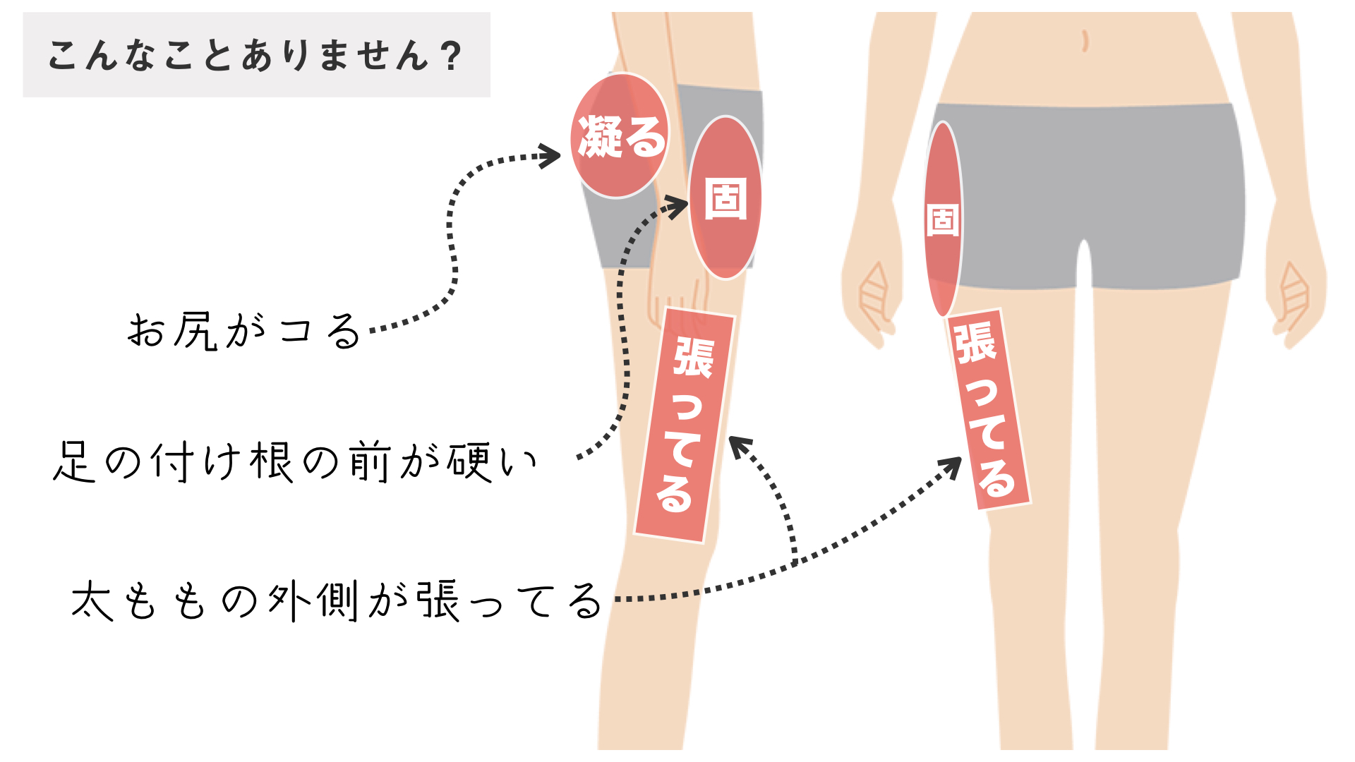 太もも 付け根 へこみ