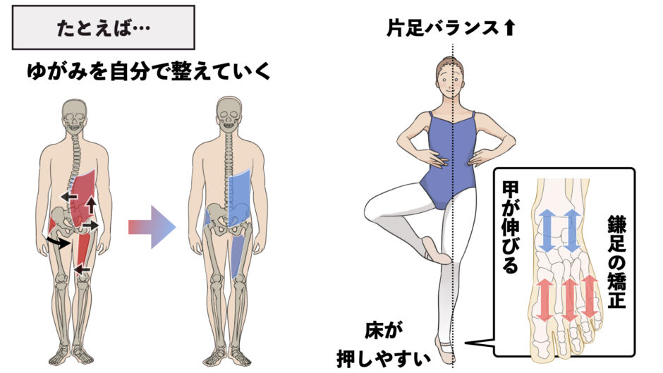 【骨盤のゆがみ矯正】3つのポイントをそろえてセルフでできる骨盤矯正 バレエダンサーさんの治療院 