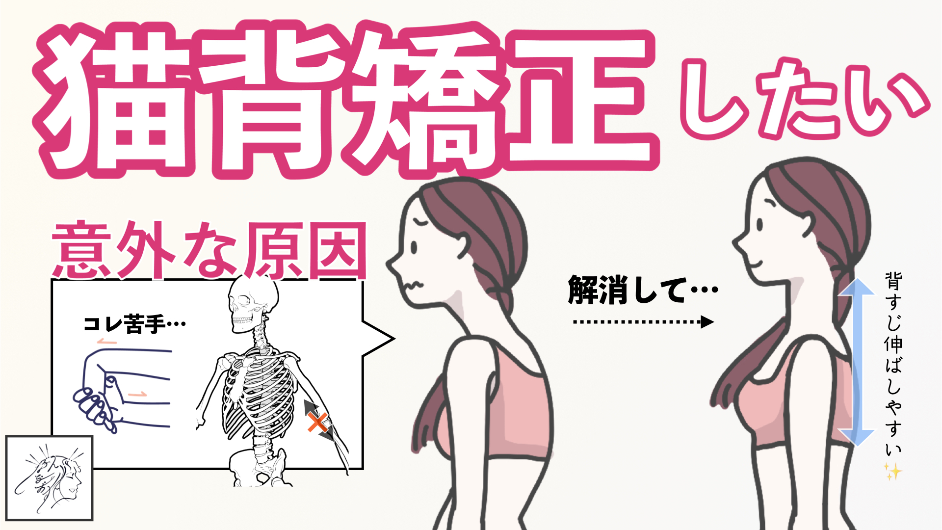 猫背の意外な原因と猫背矯正(解消)に使えるストレッチ | バレエダンサーさんの治療院
