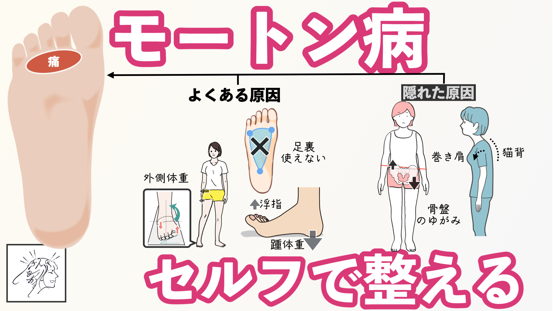 足の裏 痛い 上の方