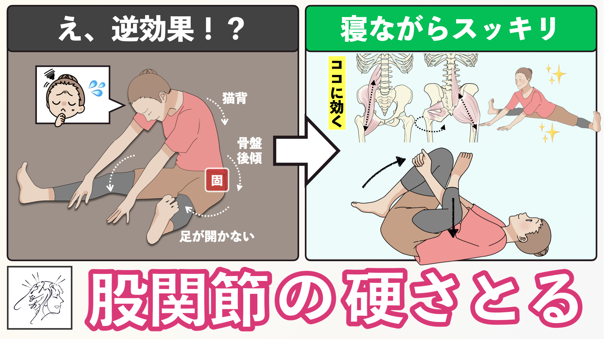 【体が硬くて開脚できない方向け】ストレッチがうまくいかない原因と寝ながらできる股関節の詰まり解消ストレッチ | バレエダンサーさんの治療院
